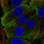 Kallikrein 7 Polyclonal Antibody