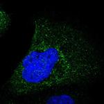 Maspin Polyclonal Antibody