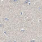 Maspin Antibody in Immunohistochemistry (Paraffin) (IHC (P))