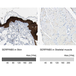 Maspin Antibody in Immunohistochemistry (Paraffin) (IHC (P))