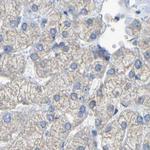 Maspin Antibody in Immunohistochemistry (Paraffin) (IHC (P))
