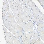 Maspin Antibody in Immunohistochemistry (Paraffin) (IHC (P))