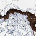 Maspin Antibody in Immunohistochemistry (Paraffin) (IHC (P))