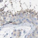 Maspin Antibody in Immunohistochemistry (Paraffin) (IHC (P))