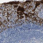 Maspin Antibody in Immunohistochemistry (Paraffin) (IHC (P))