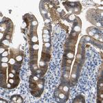 Maspin Antibody in Immunohistochemistry (Paraffin) (IHC (P))