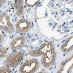 CAPG Antibody in Immunohistochemistry (Paraffin) (IHC (P))