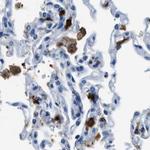 CAPG Antibody in Immunohistochemistry (Paraffin) (IHC (P))