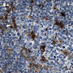 CAPG Antibody in Immunohistochemistry (Paraffin) (IHC (P))