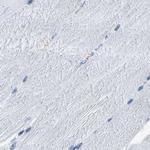 CAPG Antibody in Immunohistochemistry (Paraffin) (IHC (P))