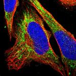 eIF4E2 Polyclonal Antibody