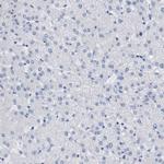 TAGLN Antibody in Immunohistochemistry (Paraffin) (IHC (P))