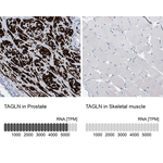 TAGLN Antibody in Immunohistochemistry (Paraffin) (IHC (P))