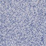 TAGLN Antibody in Immunohistochemistry (Paraffin) (IHC (P))