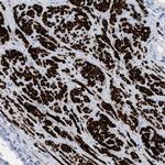 TAGLN Antibody in Immunohistochemistry (Paraffin) (IHC (P))