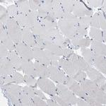 TAGLN Antibody in Immunohistochemistry (Paraffin) (IHC (P))