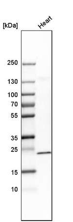 TAGLN Antibody in Western Blot (WB)