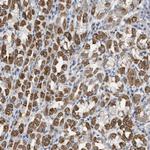 LGP2 Polyclonal Antibody