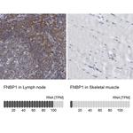 FNBP1 Antibody in Immunohistochemistry (Paraffin) (IHC (P))