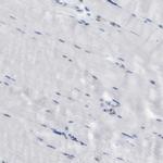 FNBP1 Antibody in Immunohistochemistry (Paraffin) (IHC (P))