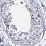 FNBP1 Antibody in Immunohistochemistry (Paraffin) (IHC (P))