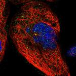 BRMS1 Polyclonal Antibody