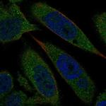 Biliverdin Reductase Polyclonal Antibody