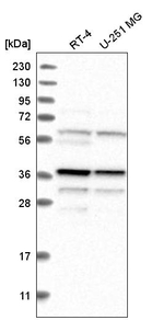 Biliverdin Reductase Antibody in Western Blot (WB)