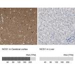 NCS1 Antibody in Immunohistochemistry (Paraffin) (IHC (P))