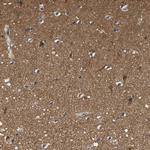 NCS1 Antibody in Immunohistochemistry (Paraffin) (IHC (P))