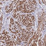 NET1 Antibody in Immunohistochemistry (Paraffin) (IHC (P))