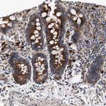 CMG1 Polyclonal Antibody