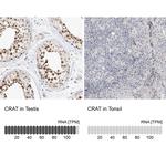 CAT1 Polyclonal Antibody