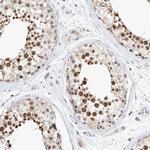 CAT1 Antibody in Immunohistochemistry (Paraffin) (IHC (P))