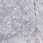 CAT1 Antibody in Immunohistochemistry (Paraffin) (IHC (P))