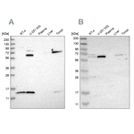 CAT1 Antibody in Western Blot (WB)