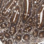 CIDEC Polyclonal Antibody