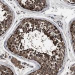 RNF216 Polyclonal Antibody