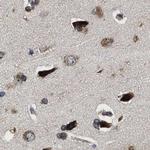 RCAS1 Antibody in Immunohistochemistry (Paraffin) (IHC (P))