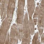 HTRA3 Antibody in Immunohistochemistry (Paraffin) (IHC (P))