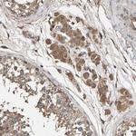 HTRA3 Antibody in Immunohistochemistry (Paraffin) (IHC (P))