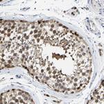 KLHL1 Polyclonal Antibody