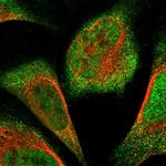 FAM104A Polyclonal Antibody