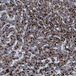 HSD17B4 Antibody in Immunohistochemistry (Paraffin) (IHC (P))