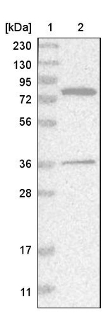 HSD17B4 Antibody in Western Blot (WB)