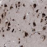 PPT1 Polyclonal Antibody