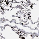 PPT1 Antibody in Immunohistochemistry (Paraffin) (IHC (P))