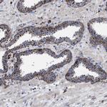 PPT1 Antibody in Immunohistochemistry (Paraffin) (IHC (P))