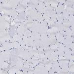 PPT1 Antibody in Immunohistochemistry (Paraffin) (IHC (P))