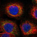 SIRT5 Polyclonal Antibody